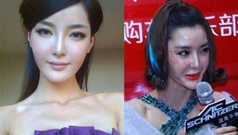 点击图片查看详情 整容失败_整容失败的女明星