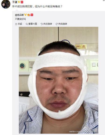跟猴年吉祥物康康“撞脸”？警惕患上这两种病！