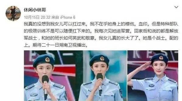 杨幂声音发嗲不好听的背后，原来还真的是“有病”