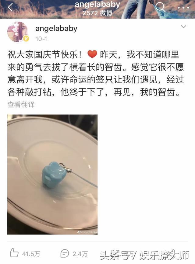 baby又变样了，是做了烤瓷牙吗？网友：神似热巴又撞脸赵薇！