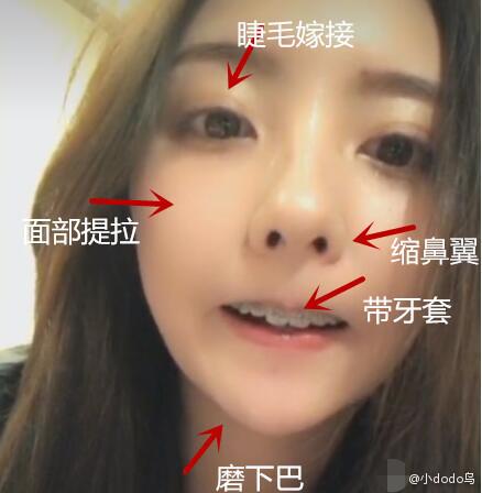 王思聪前女友豆得儿脸部大调疑整容？本尊怒怼回应！