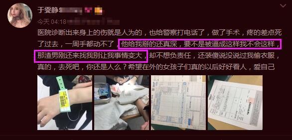 网红于雯静爆料被韩国男友打伤表示委屈，而有网友说是于雯静不好