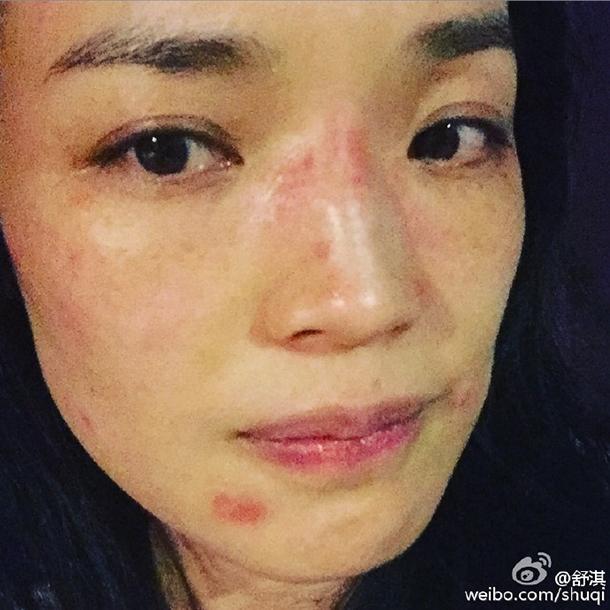 李维嘉短裤拖鞋逛机场真任性，他脖子上的红点点是得病了吧？