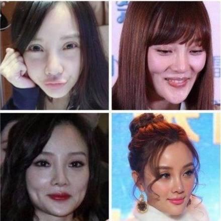 八大整容失败的女明星，第五个吓到我了，千万不能一个人晚上看