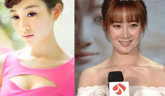八大整容失败的女明星，第五个吓到我了，千万不能一个人晚上看
