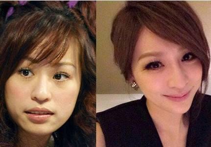 八大整容失败的女明星，第五个吓到我了，千万不能一个人晚上看