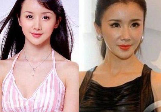 八大整容失败的女明星，第五个吓到我了，千万不能一个人晚上看