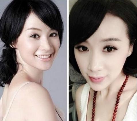 八大整容失败的女明星，第五个吓到我了，千万不能一个人晚上看
