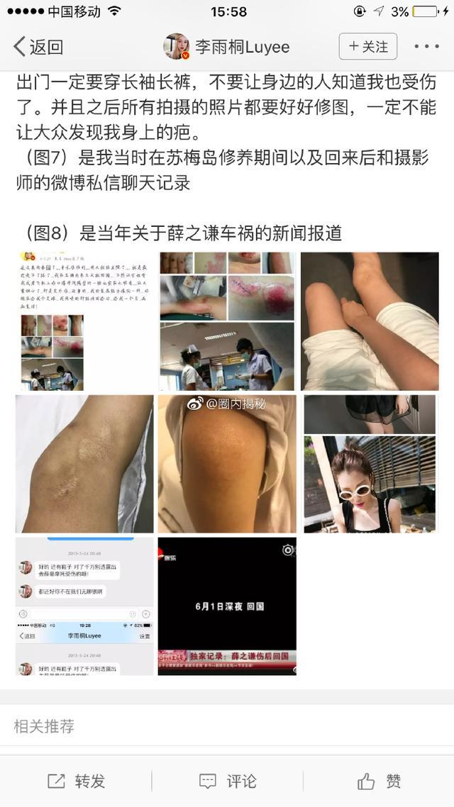 薛之谦节目中曾主动提起车祸：我整个人被撞飞出去 浑身是血