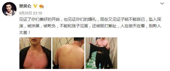 娱乐圈又一次再现家暴？双方各持己见，网友纷纷直呼：太假了吧！