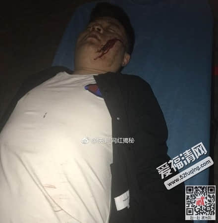 快手暴躁男友帅蛋出车祸是真的吗 目前生死未卜事件始末真相