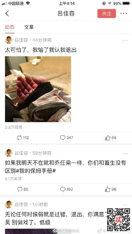 吕佳容秒删微博背后真相 女星吕佳容个人资料受伤原因被潜规则了吗